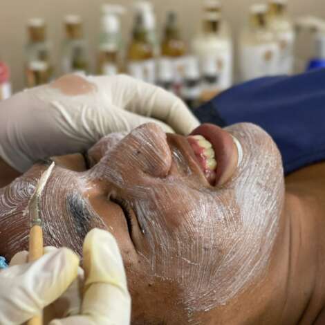 Sesiones de peeling facial (3 sesiones)